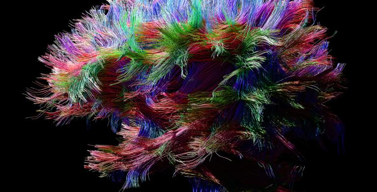 The Brain Synapse Main Image