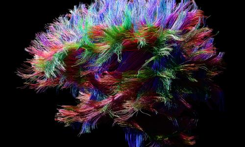 The Synapse visualization